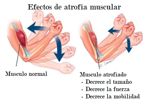 effects of atrophy